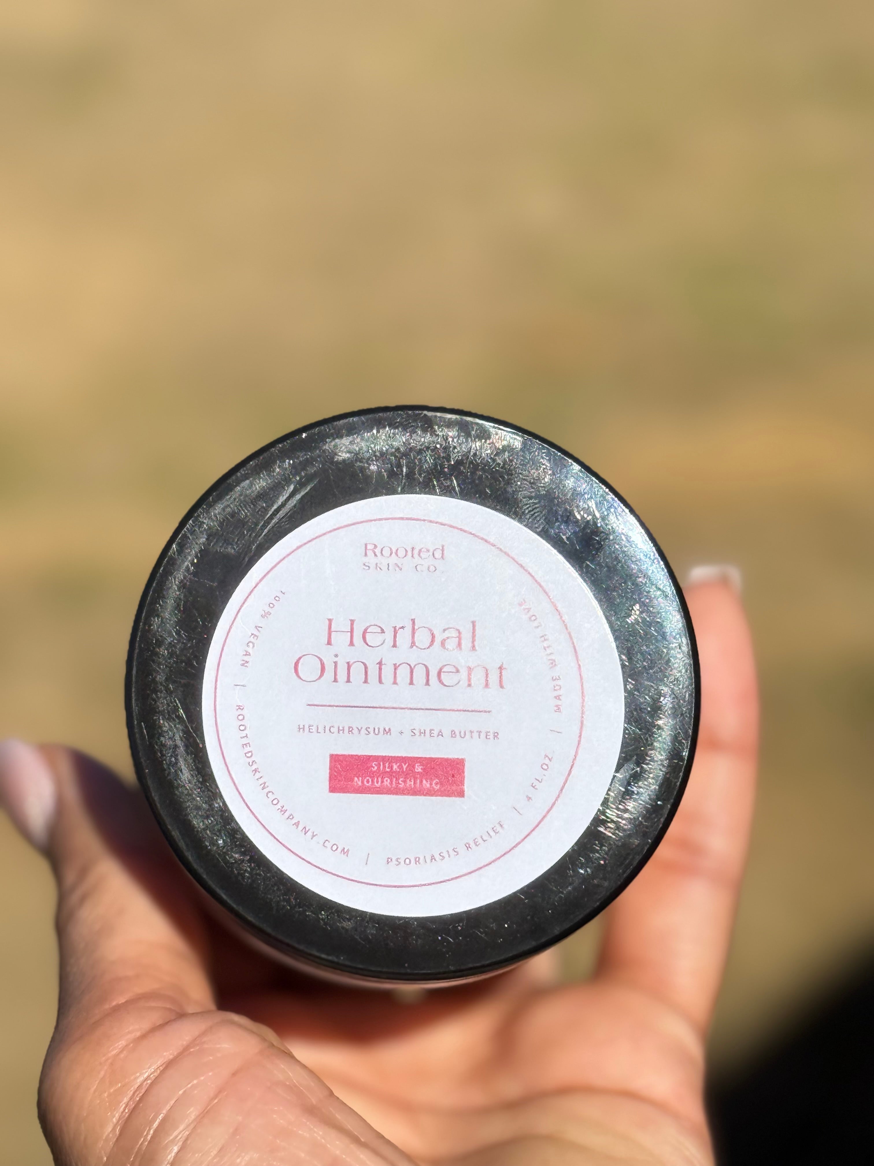 Herbal Ointment- Psoriasis relief
