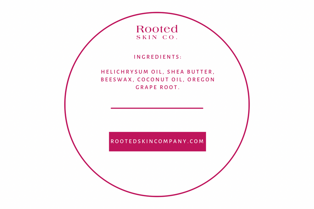 Herbal Ointment- Psoriasis relief